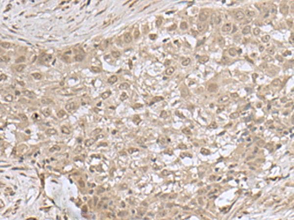 NEUROG3 / NGN3 / Neurogenin 3 Antibody