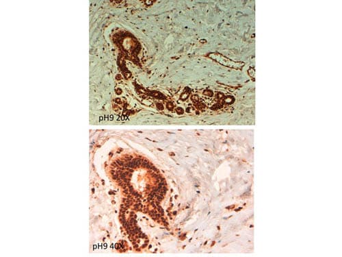ABCB5 Antibody (Internal)
