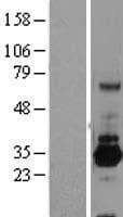 SRPRB Protein (Over-Expression Lysate Myc-DDK (Flag))
