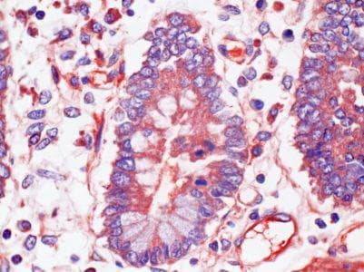 ACKR4 / CCRL1 / CCR11 Antibody (clone 1G4)