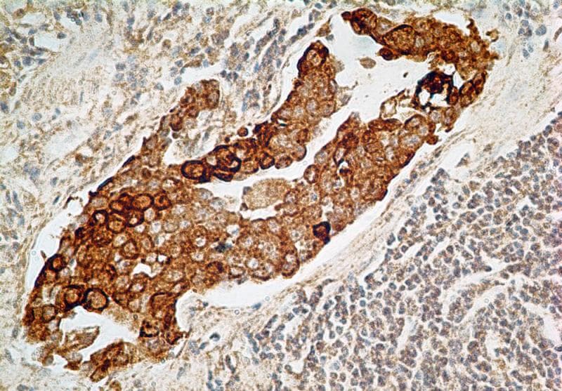 IL27RA Antibody (aa200-250, clone 34N4G11)