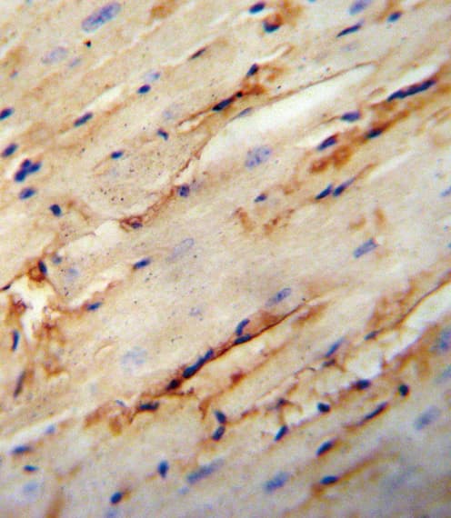 Polyclonal Rabbit anti-Human COL5A1 / Collagen V Alpha 1 Antibody (aa54-82, IHC, WB)