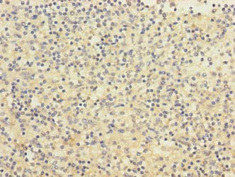 PIGL Antibody