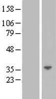 LGALS12 / Galectin 12 Protein (Over-Expression Lysate Myc-DDK (Flag))