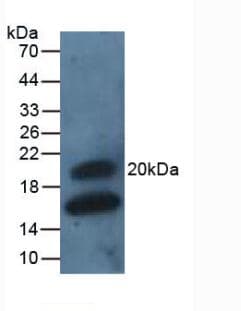PathPlus™ GREM1 / Gremlin-1 Antibody (aa26-184)
