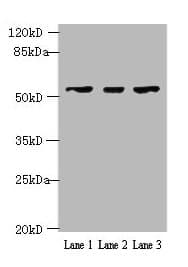 Polyclonal Rabbit anti-Human IFIT5 Antibody (IHC, WB)