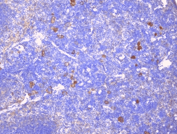 LY9 / CD229 Antibody