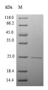 Mouse CTDP1 / FCP1 Protein (Recombinant 10His, N-terminus + Myc, C-terminus)