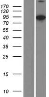Villin-Like / VILL Protein (Over-Expression Lysate Myc-DDK (Flag))