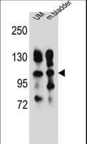 ITGA5/Integrin Alpha 5/CD49e Antibody (aa575-602)