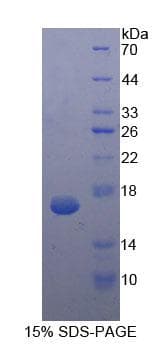 Human Procalcitonin Protein (Recombinant His-T7)