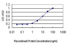 GLNRS / QARS Antibody (clone 5F5)
