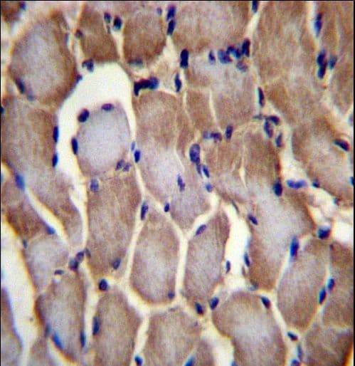 SELN / SEPN1 Antibody (aa417-445)