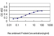 IHC-plus™ NPC / NPC1 Antibody (clone 4H2)