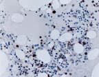 Polyclonal Rabbit anti-Human TRAF2 Antibody (aa87-106, IHC, WB)