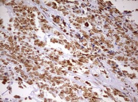 DDX56 Antibody (aa323-547, clone OTI2E5)