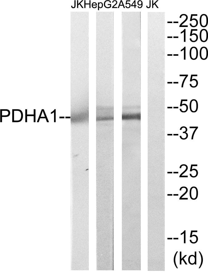 Polyclonal Rabbit anti-Human PDHA1 / PDH E1 Alpha Antibody (IHC, WB)