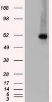 CHEK2 / CHK2 Antibody (clone OTI2F4)