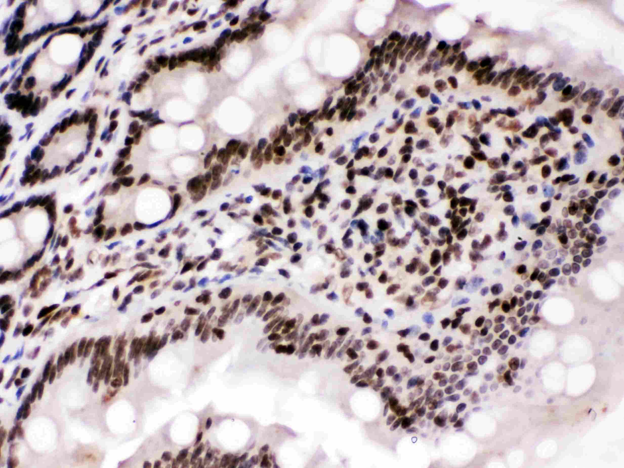 CCNT1 / Cyclin T1 Antibody