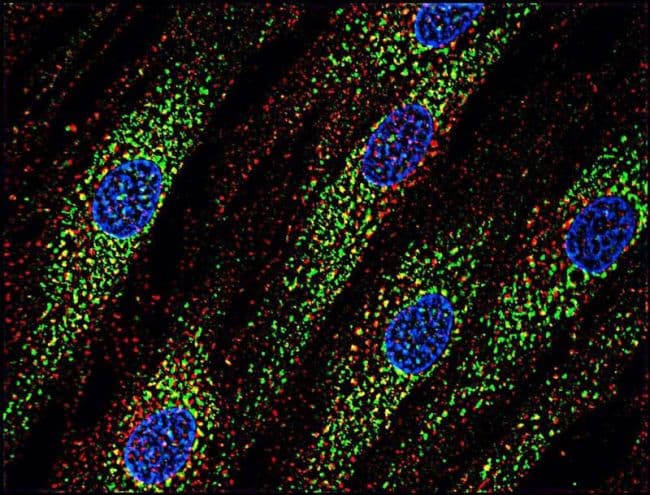 Monoclonal Mouse anti-Human CD63 Antibody (clone MEM-259, IHC, IF)