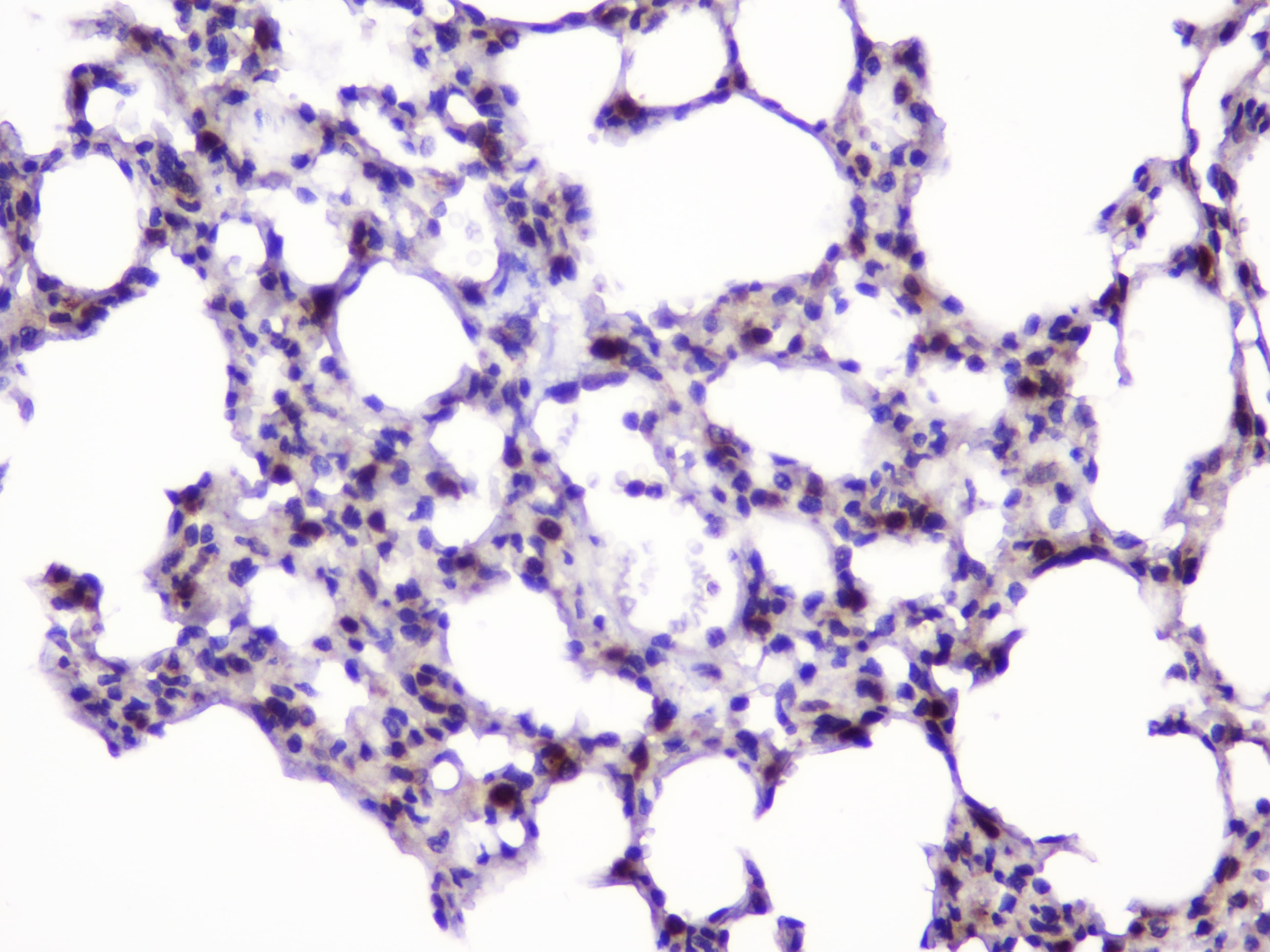 UBE2I / UBC9 Antibody