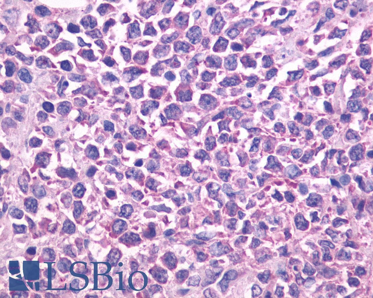 PathPlus™ ADGRE5 / CD97 Antibody (N-Terminus)