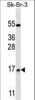 Polyclonal Rabbit anti-Human NRARP Antibody (aa56-83, WB)