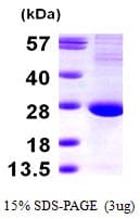 Human TSN / Translin Protein (Recombinant)