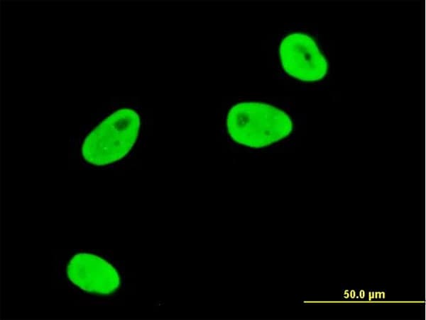 IHC-plus™ SGK1 / SGK Antibody (clone 3C4)