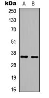 HMG20B / BRAF35 Antibody (N-Terminus)