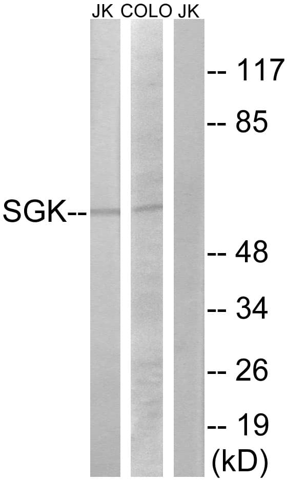 Polyclonal Rabbit anti-Human SGK1 / SGK Antibody (aa381-430, IHC, WB)