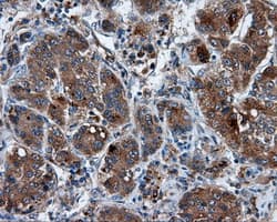 TLDC1 / KIAA1609 Antibody (clone OTI3C4, Carrier-free)