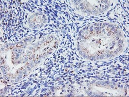 HES1 / HES-1 Antibody (clone OTI7B9)