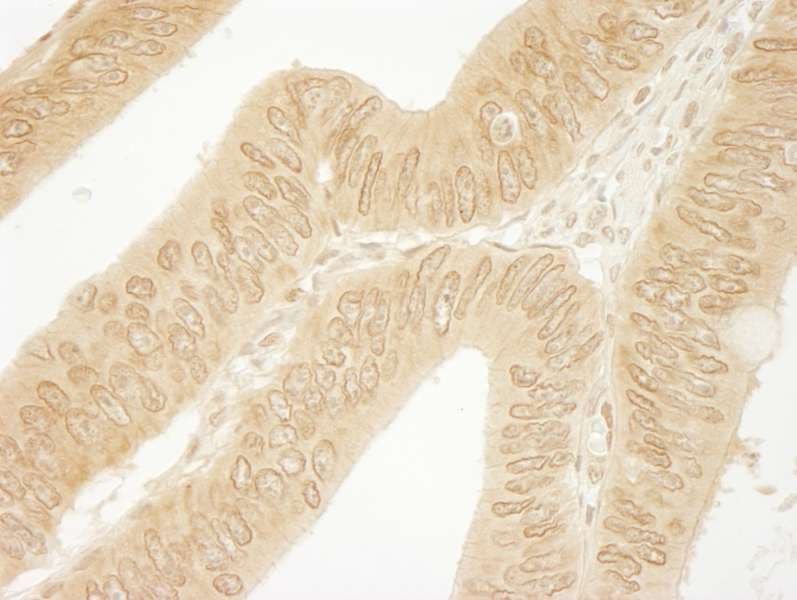 Polyclonal Rabbit anti-Human CTNND1 / p120 Catenin Antibody (aa75-125, IHC)