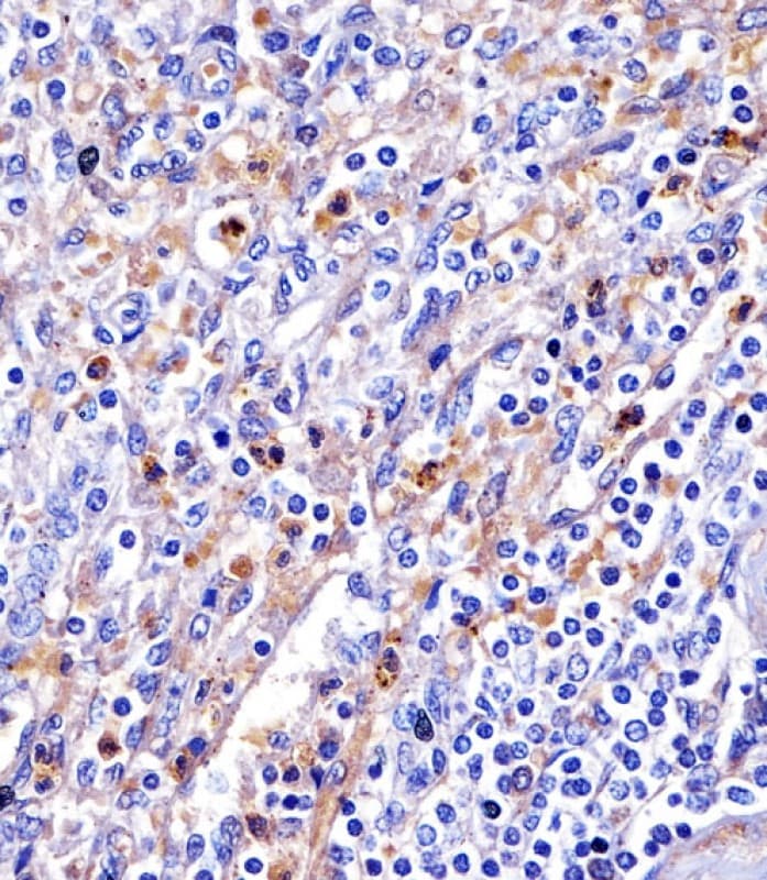 Polyclonal Rabbit anti-Human TF / Transferrin Antibody (IHC, WB)