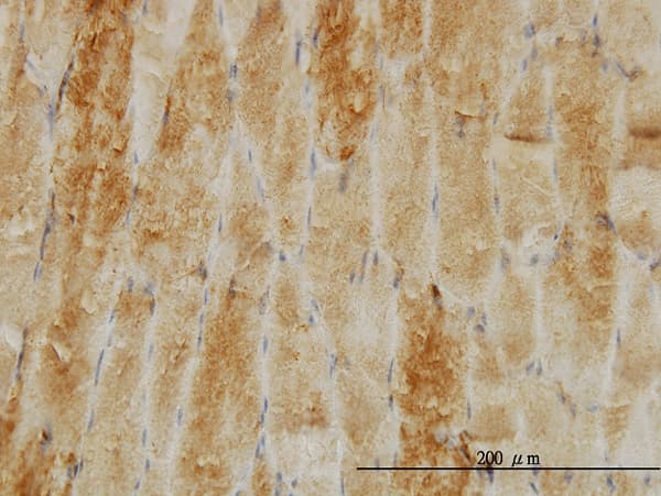 CFL2 / Cofilin 2 Antibody (clone 6G9)