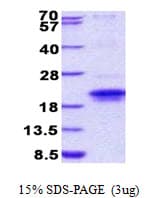 Human IGFLR1 / TMEM149 Protein (Recombinant His)