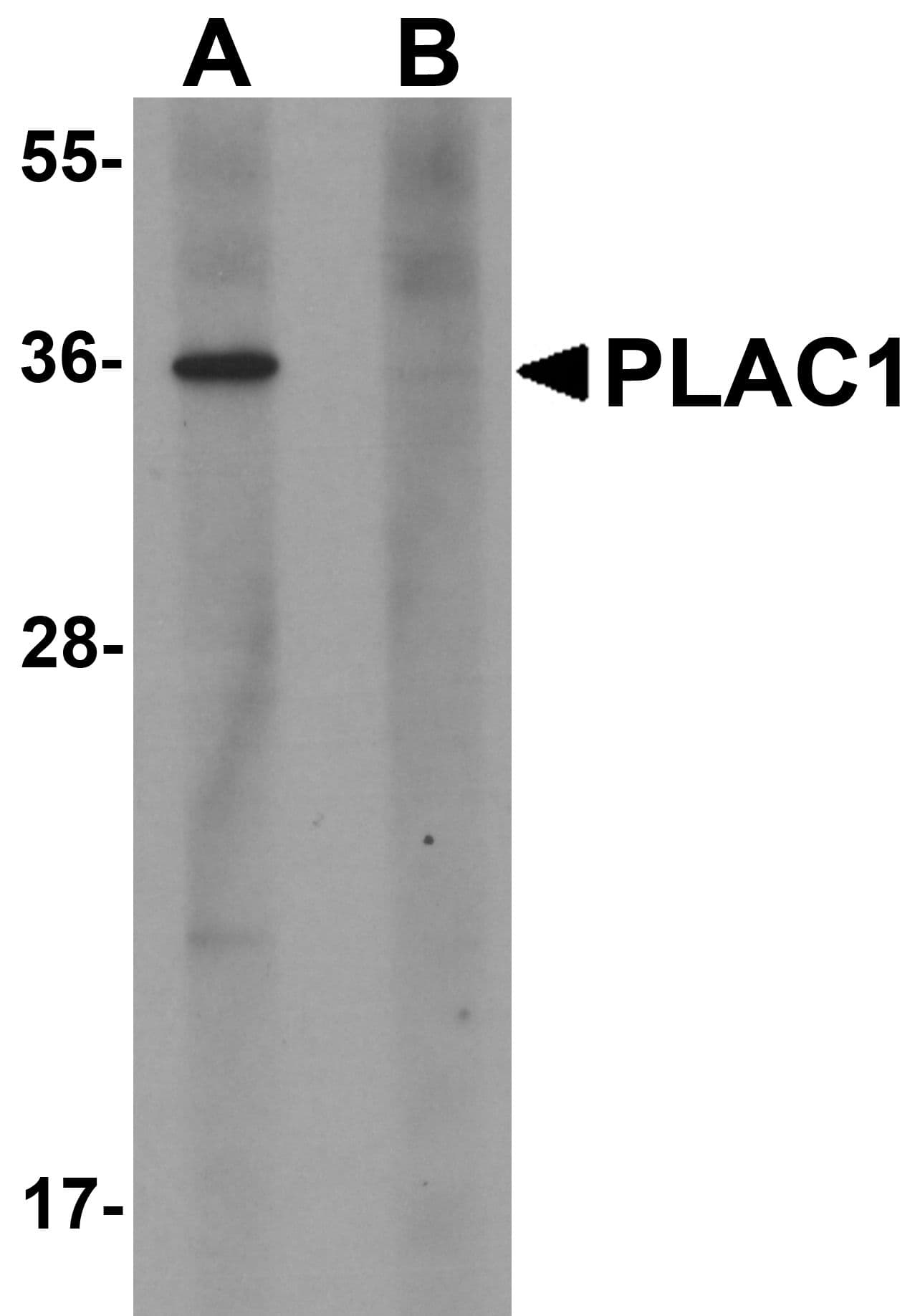 IHC-plus™ PLAC1 Antibody