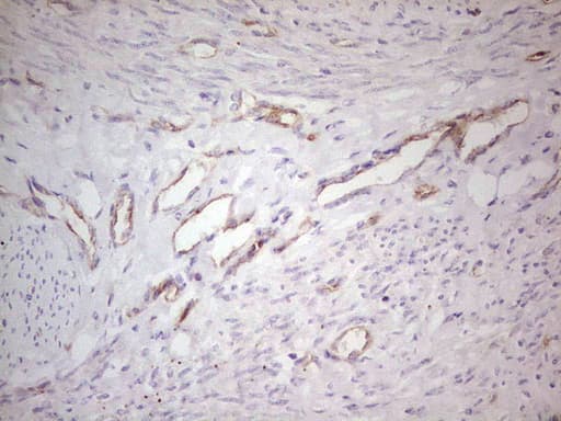 ABCB1 / MDR1 / P Glycoprotein Antibody (aa995-1280, clone OTI10H3)