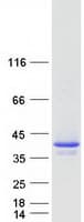 Human BIRC7 / Livin Protein (Recombinant Myc-DDK (Flag))