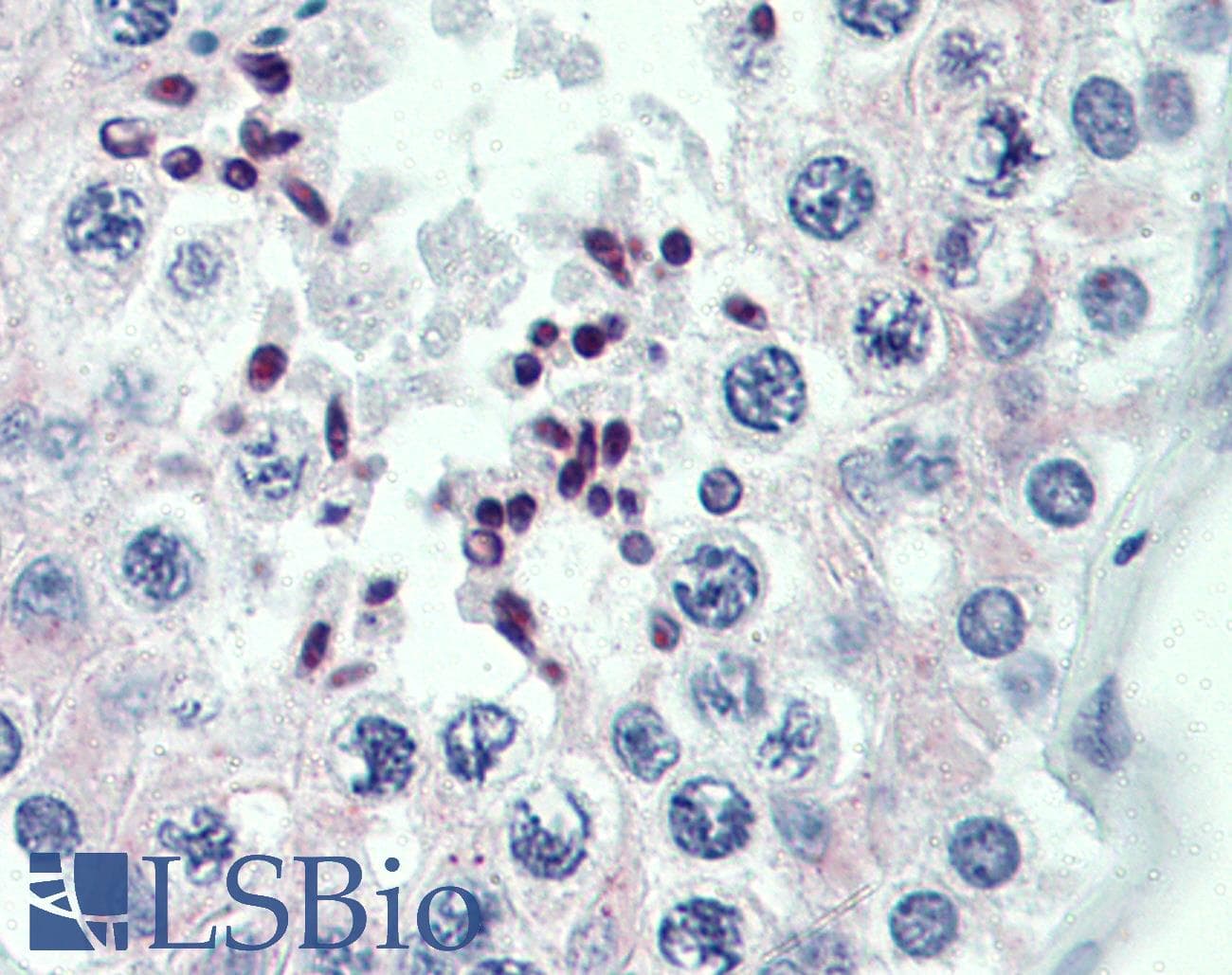 Polyclonal Rabbit anti-Human PRDM9 Antibody (aa431-480, IHC, WB)