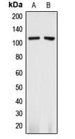 ANPEP / CD13 Antibody (C-Terminus)