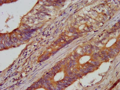 AARS Antibody