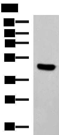 Polyclonal Rabbit anti-Human KCTD7 Antibody (IHC, WB)
