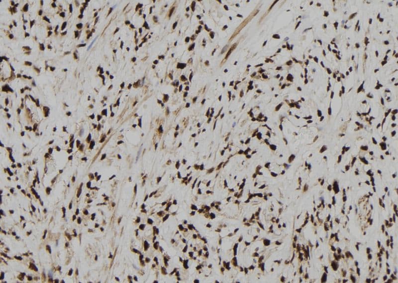 NAR / CPSF4 Antibody