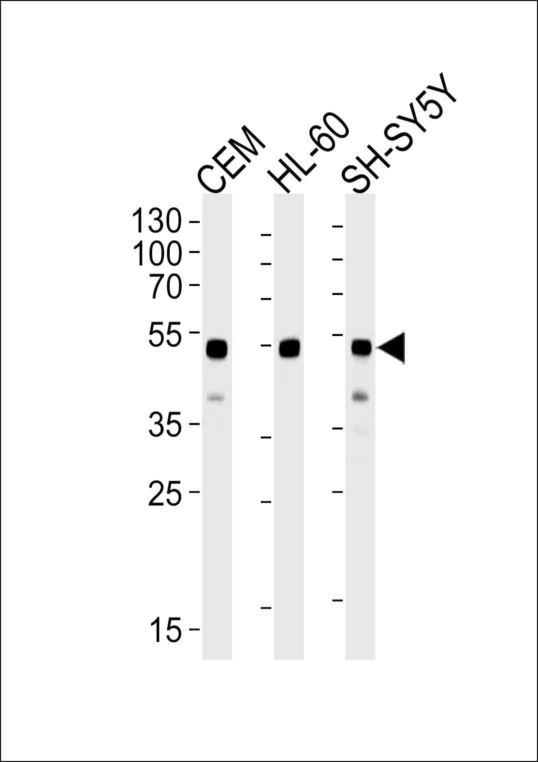 GATA3 Antibody (clone 1259CT707.136.102)