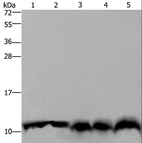 Polyclonal Rabbit anti-Human UBB / Ubiquitin B Antibody (IHC, WB)