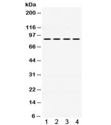 PIK3R2 / p85 Beta Antibody