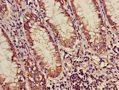 MCAD / ACADM Antibody