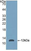 NPM1 / NPM / Nucleophosmin Antibody (aa212-292)